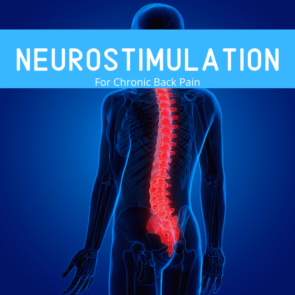 Neurostimulation For Chronic Back Pain New Jersey Comprehensive