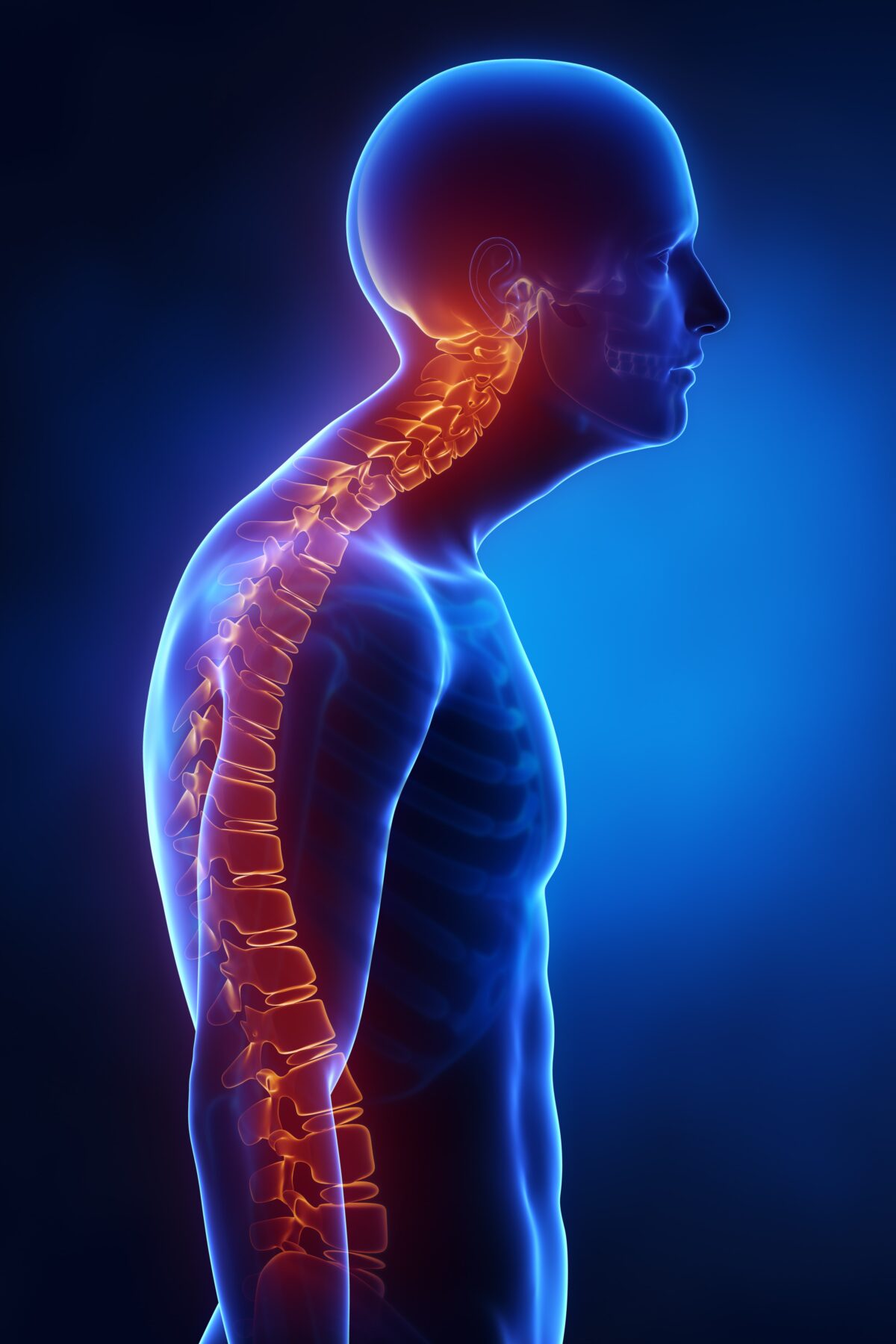 How Osteoporosis Affects The Spine New Jersey Comprehensive Spine Care