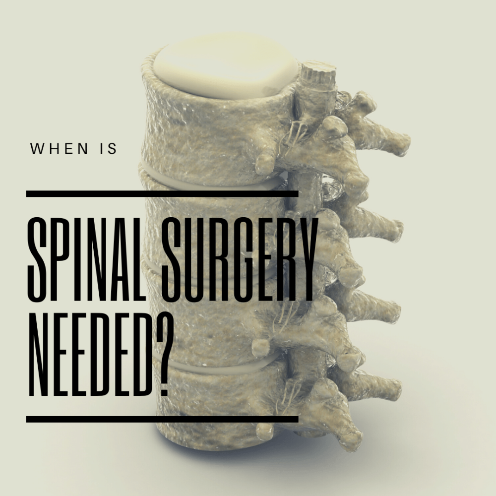 When Spine Surgery Is Needed | New Jersey | Comprehensive Spine Care