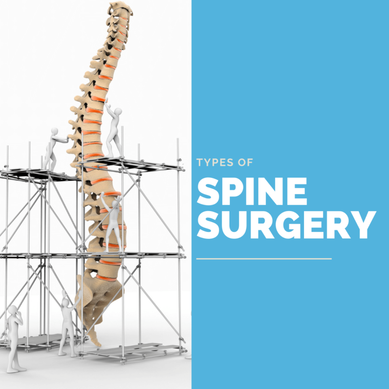 Types of spine surgery