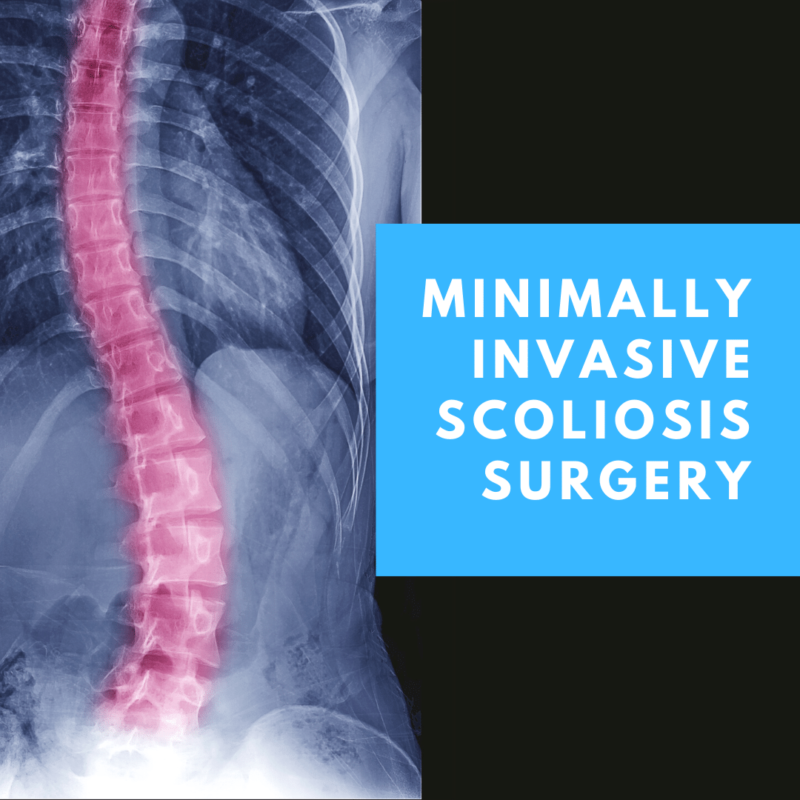 Minimally Invasive Scoliosis surgery