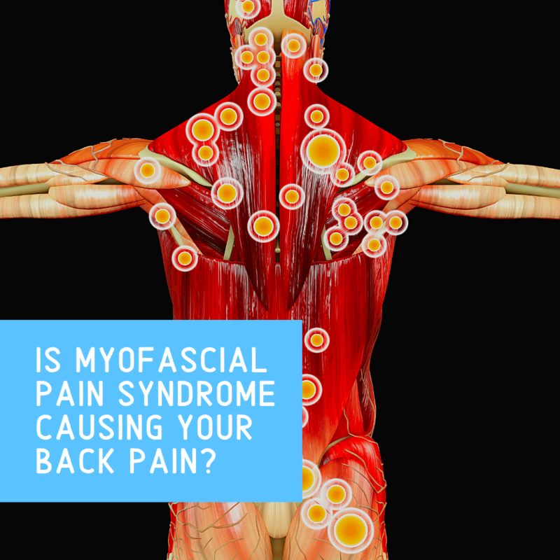 Is myofascial Pain Syndrome Causing Your Back Pain_