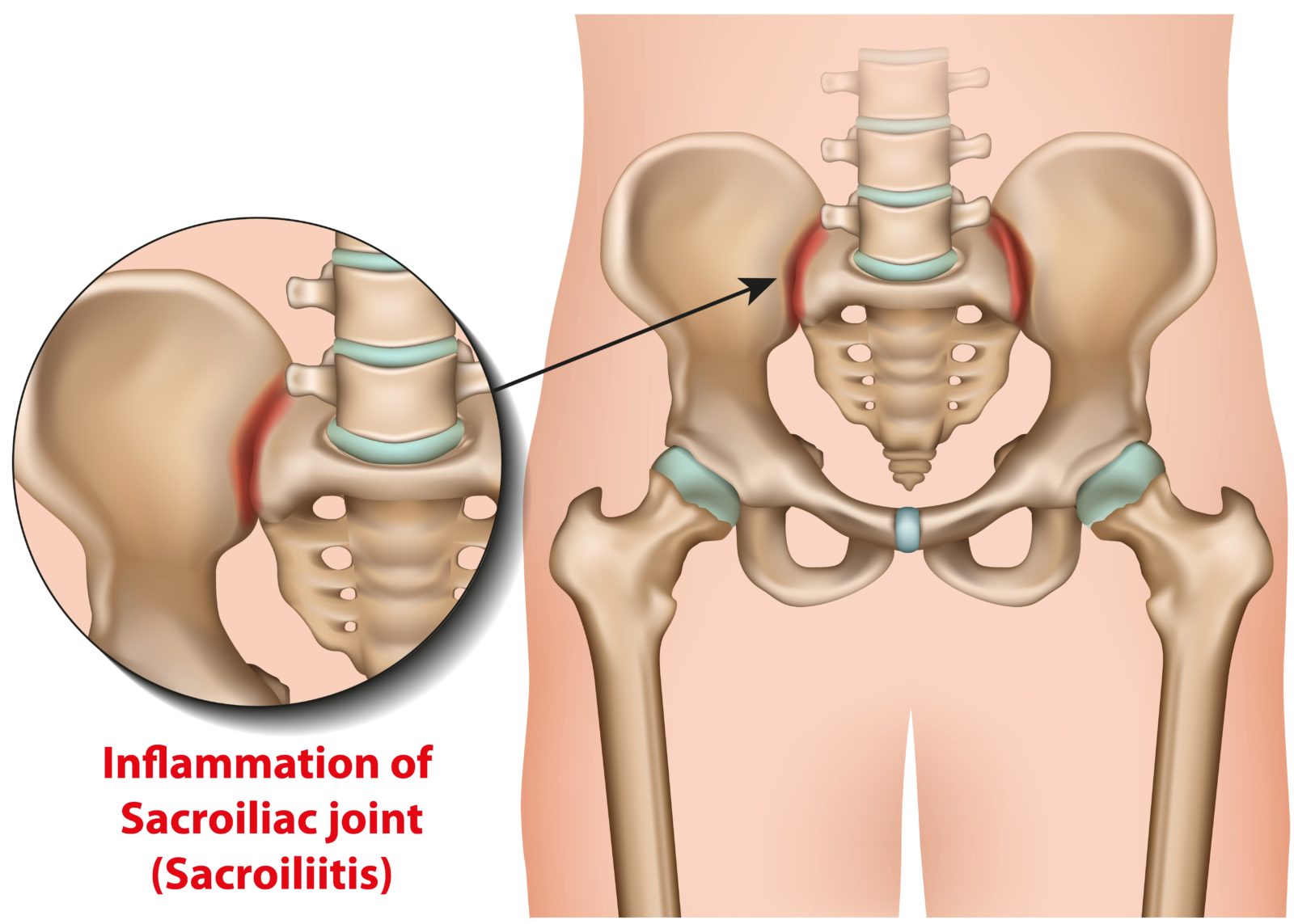 sacroiliac joints