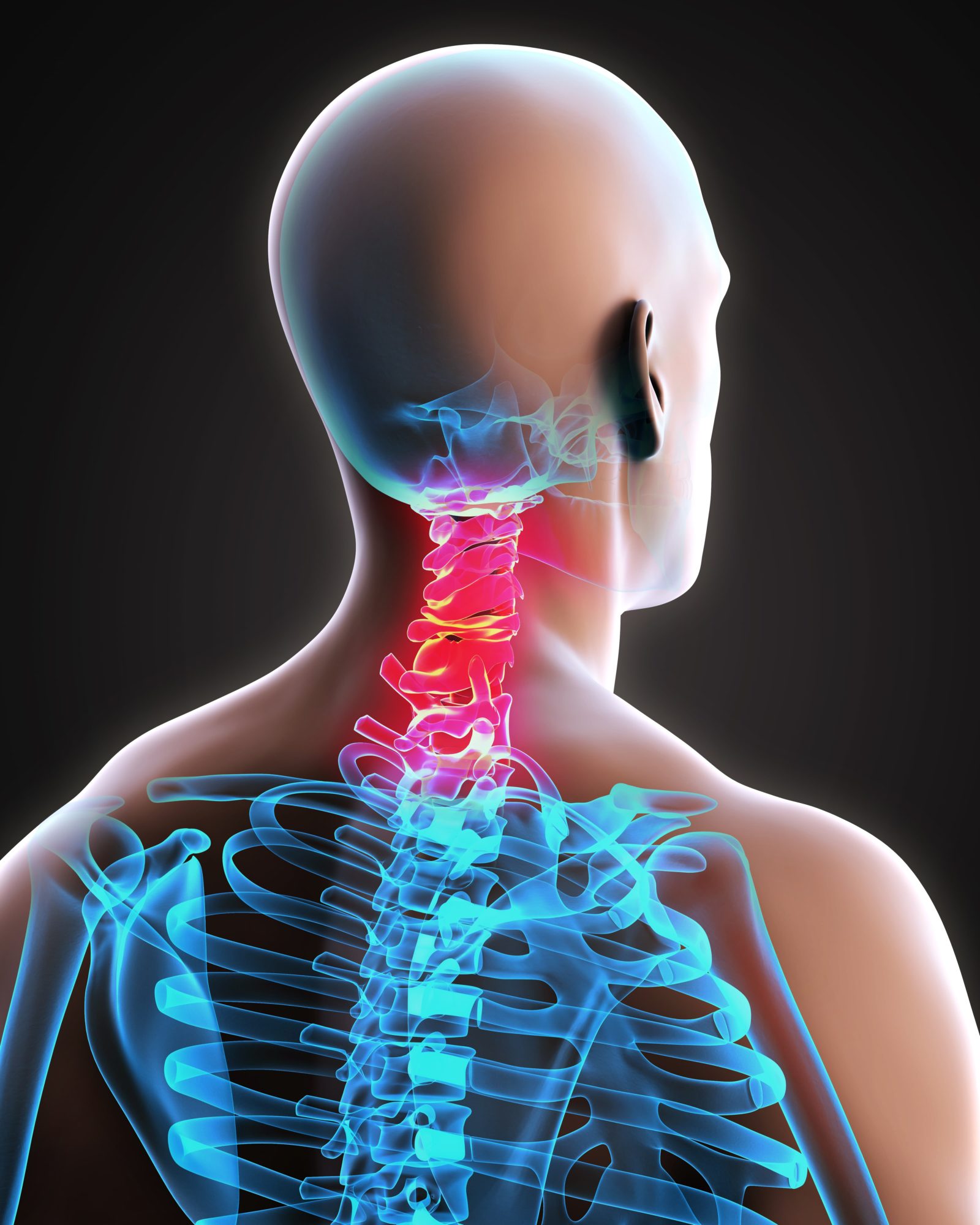 neck shown in red, rest of spine in blue
