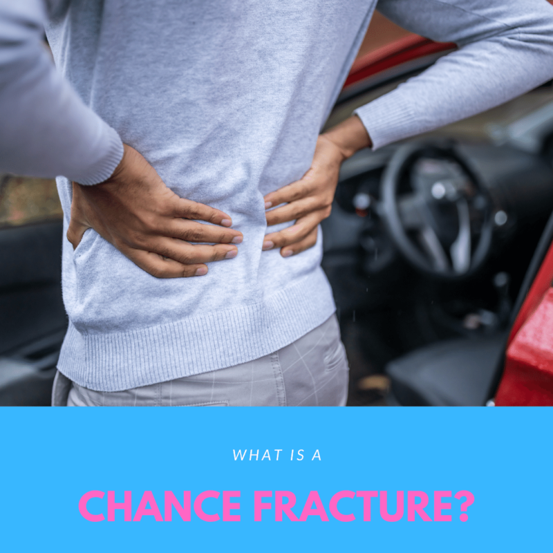 What is a Chance Fracture