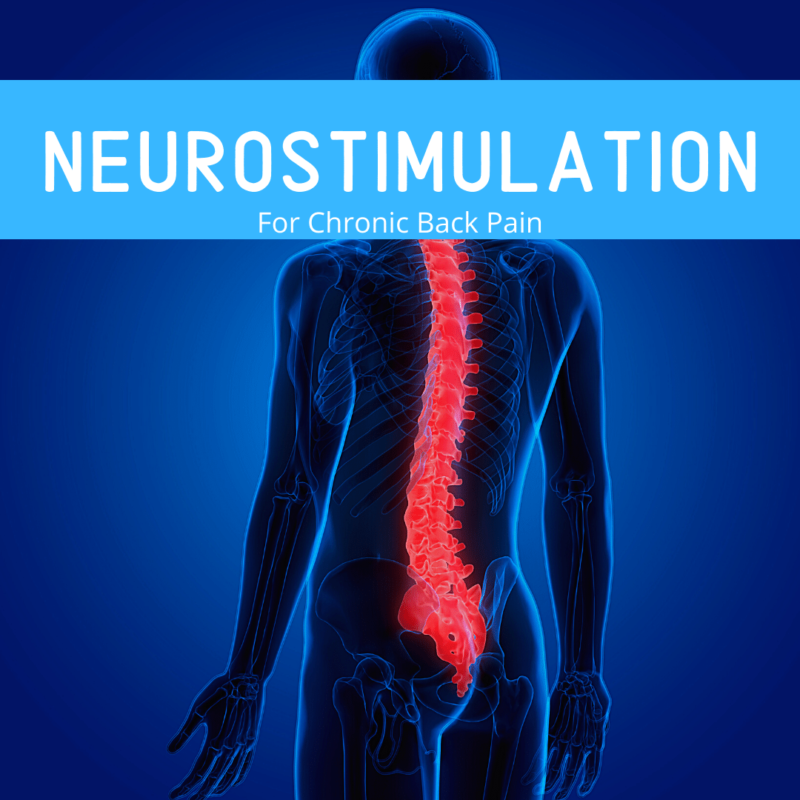 Neurostimulation for chronic back pain