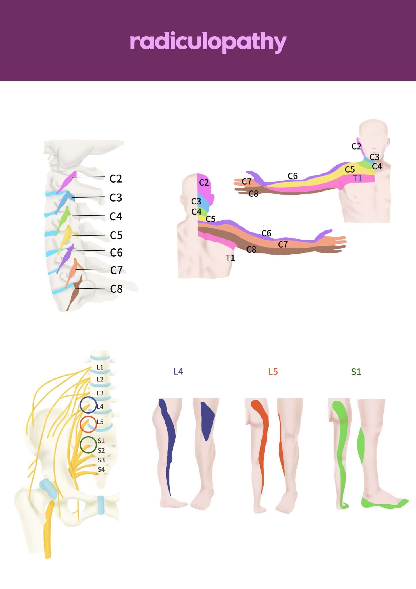 what-is-radiculopathy-new-jersey-comprehensive-spine-care