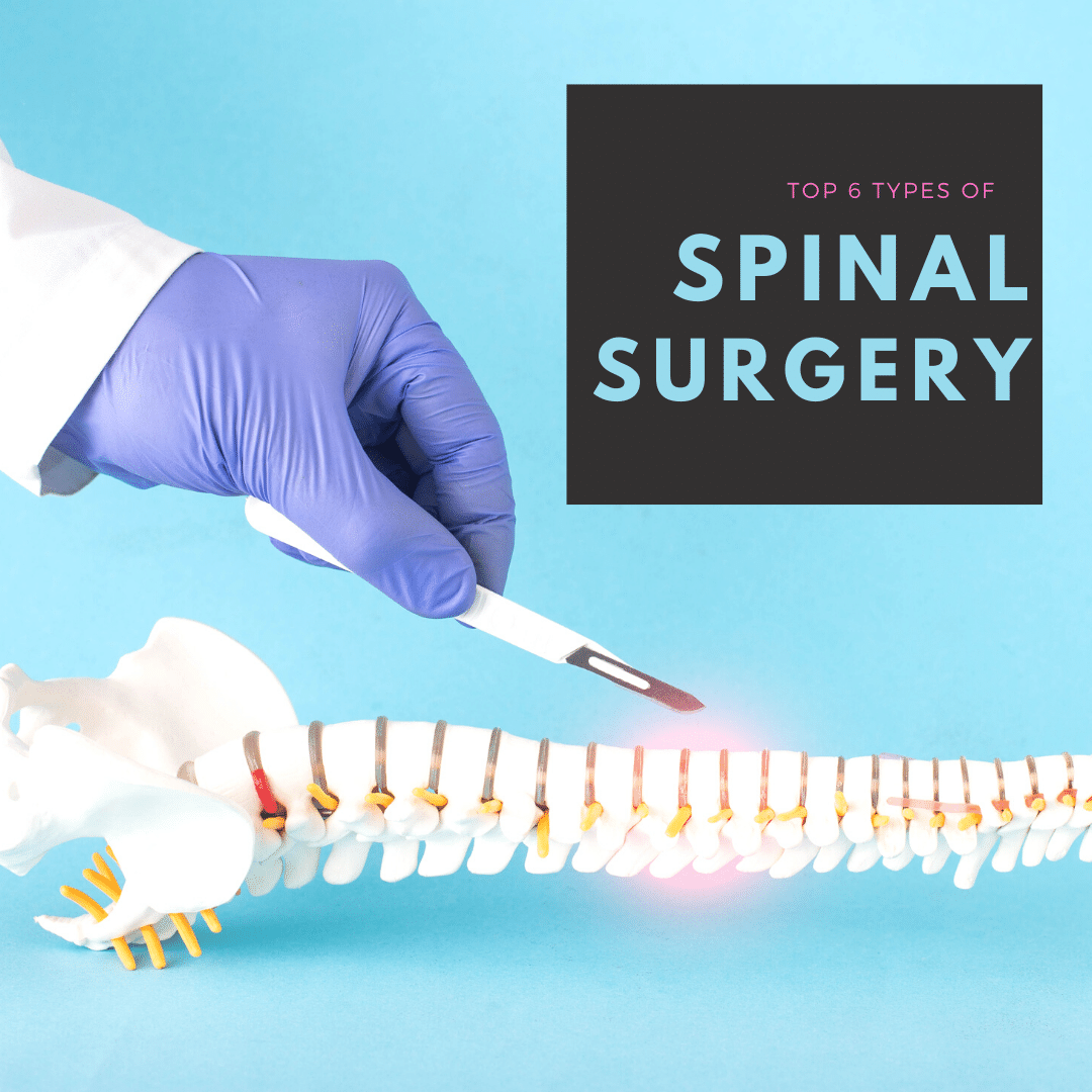 Top 6 Types of Spinal Surgery
