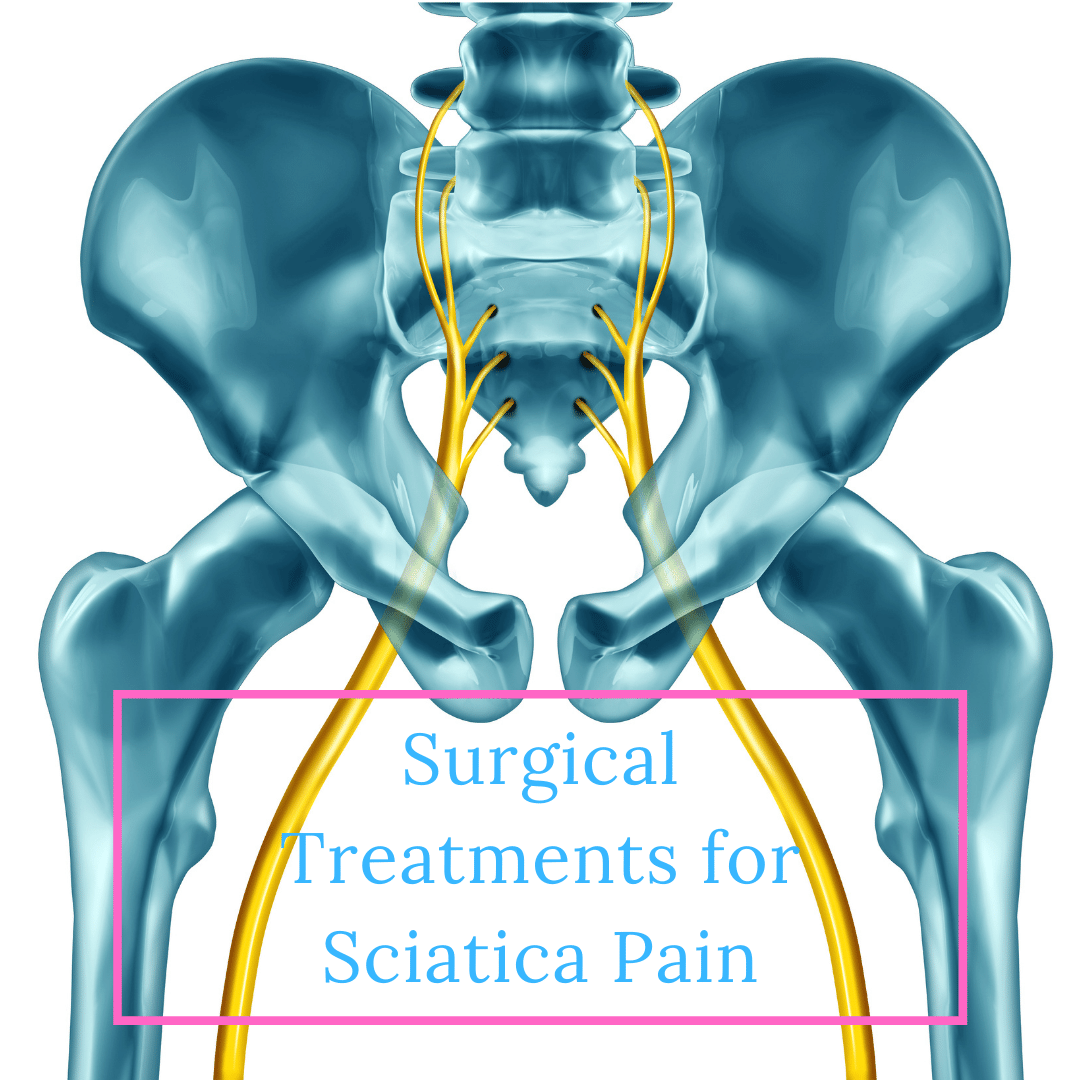 Surgical Treatments for Sciatica Pain