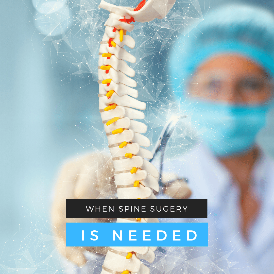 When Spine Surgery is Needed