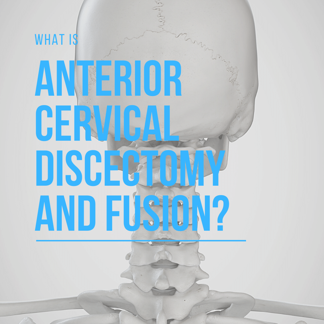 What is Anterior Cervical Discectomy and Fusion