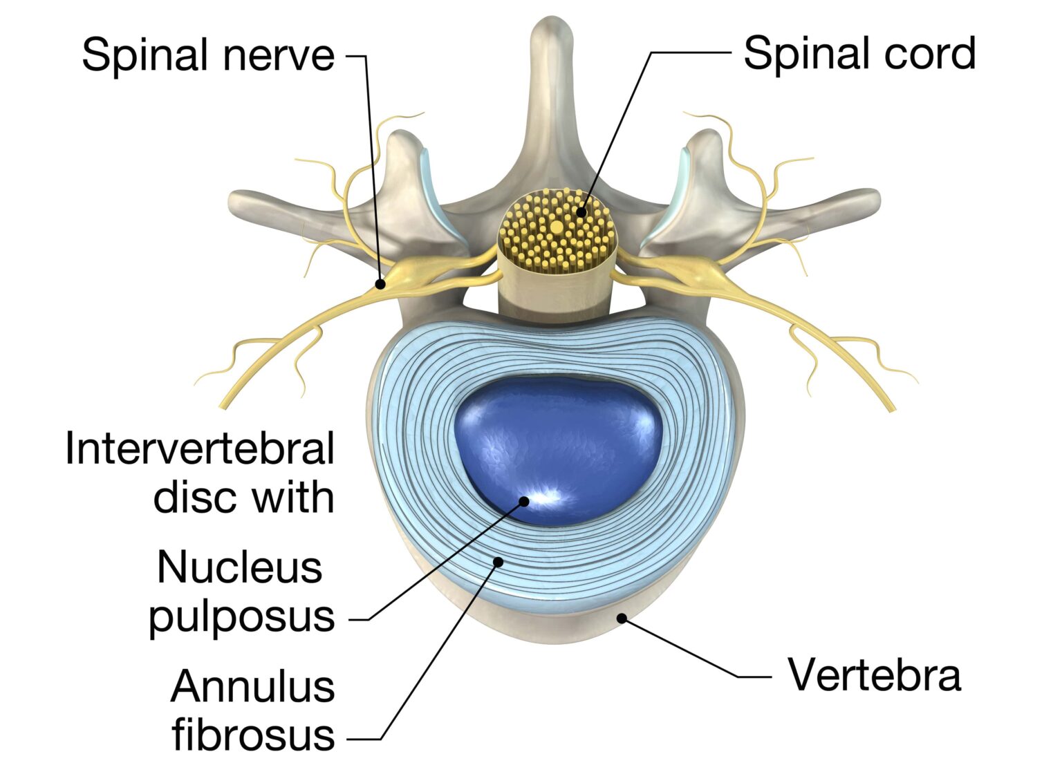 What Is Disc Desiccation? New Jersey Comprehensive Spine Care