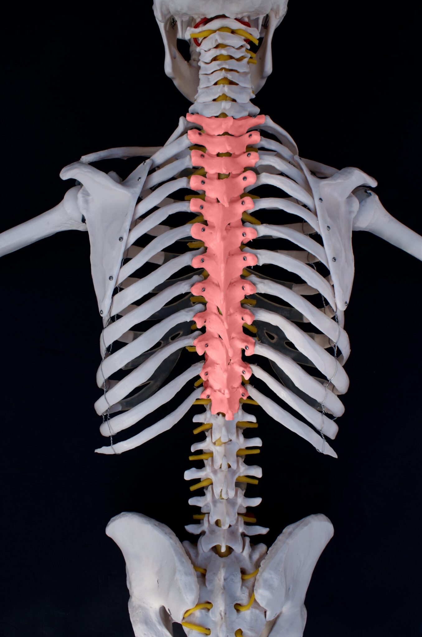 herniated-thoracic-discs-what-you-need-to-know-new-jersey